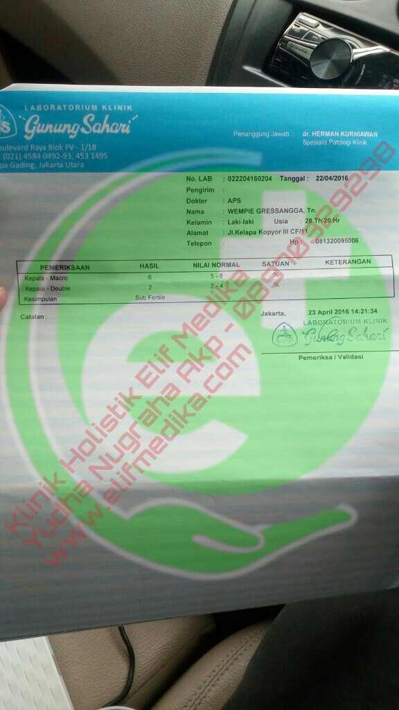 (LEMBAR 2) Setelah Pengobatan 1 Bulan Jumlah Sperma Naik 32,5 Juta/ejakulasi, Motilitas 60%, Morfologi Normal 58% (LEMBAR 2) Setelah Pengobatan 1 Bulan Jumlah Sperma Naik 32,5 Juta/ejakulasi, Motilitas 60%, Morfologi Normal 58%