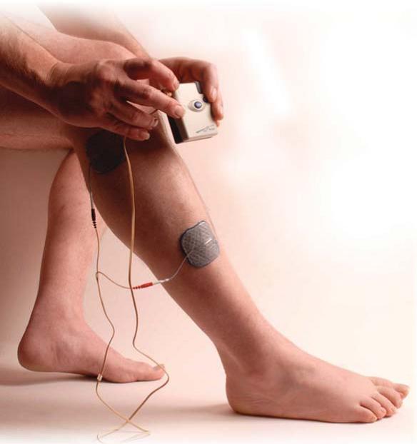 Functional electrical stimulation in neurorehabilitation