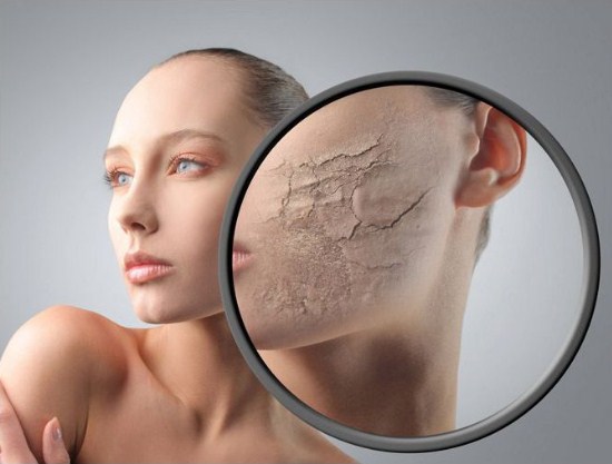 Cara Mengatasi Kulit Kering Cara Mengatasi Kulit Kering