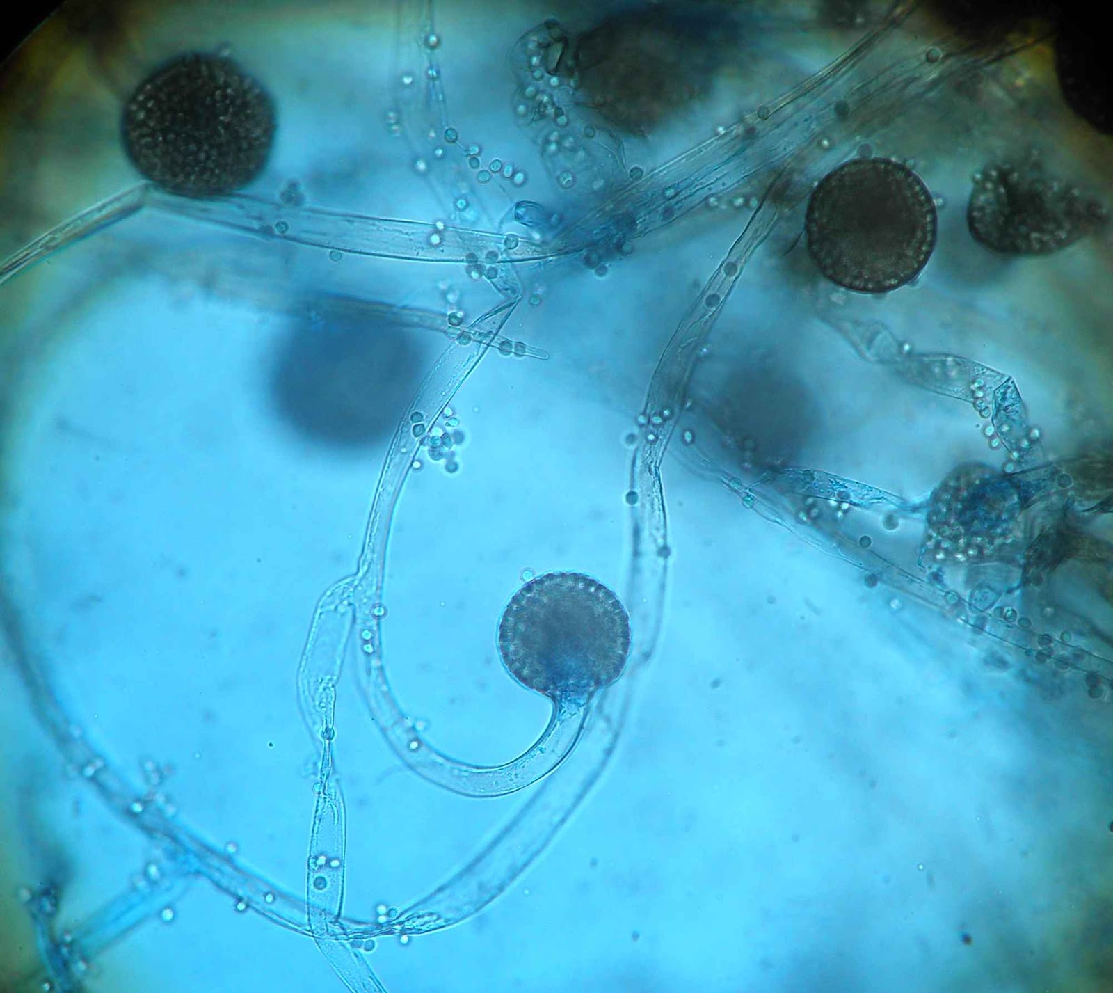 Мукор клетка. Mucor hiemalis. Клетка плесени мукора под микроскопом. Клетка мукора под микроскопом. Грибок мукор.