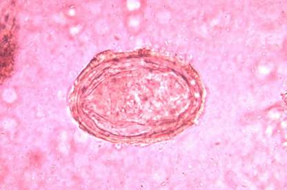 Schistosoma spp