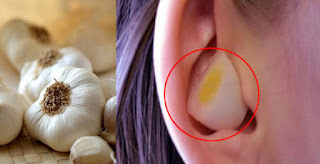 MIRACLE BAWANG! Subukan mong Maglagay ng Bawang sa Iyong Tenga At Tiyak Magugulat ka sa Resulta MIRACLE BAWANG! Subukan mong Maglagay ng Bawang sa Iyong Tenga At Tiyak Magugulat ka sa Resulta