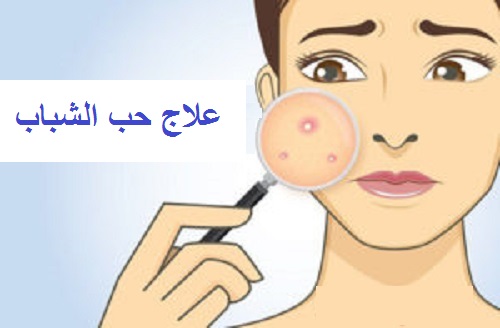 نصائح للوقاية من حب الشباب - الجنان نصائح للوقاية من حب الشباب - الجنان
