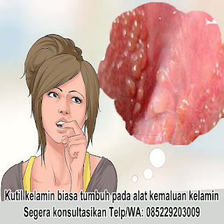Foto OBAT KUTIL KELAMIN 100% EFEKTIF DI APOTIK KIMIA FARMA K24