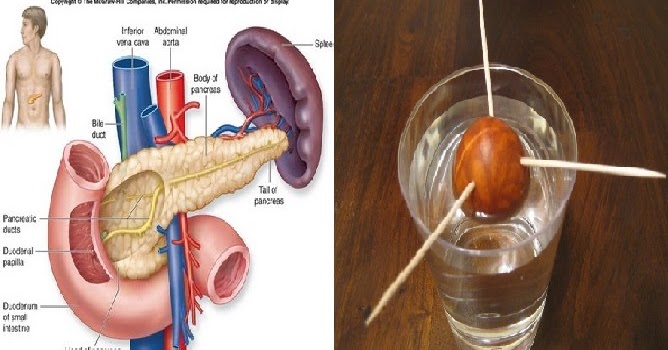 Bandarq: Gunakan Biji Alpukat Untuk Mengatasi Diabetes