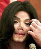 Michael Jackson bad plastic surgery