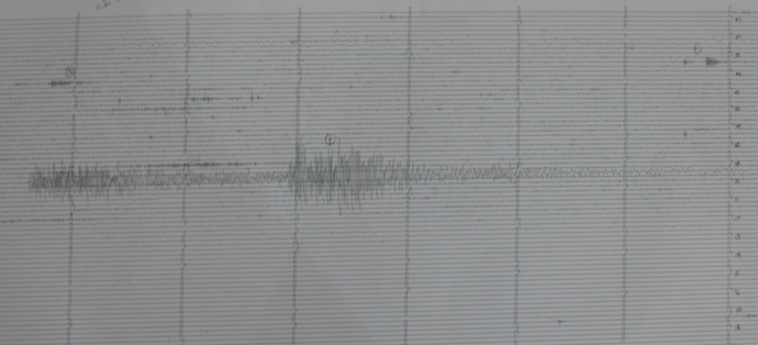 Earthquake Seismograph Analog as Earthquake Instrumentation Earthquake Seismograph Analog as Earthquake Instrumentation