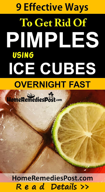 9 Working Ways To Use Ice To Clear Pimples Overnight Fast Ice Cubes For Pimples, How To Use Ice For Pimples, Ice For Acne, How To Get Rid Of Pimples, Home Remedies For Pimples, Pimples Home Remedies, Get Rid Of Pimples Overnight Fast, Pimples Treatment, How To Treat Pimples, How To Cure Pimples, Pimples Remedies, Remedies For Pimples, Cure Pimples, Treatment For Pimples, Best Pimples Treatment, Pimples Relief, How To Get Relief From Pimples, Relief From Pimples, How To Get Rid Of Pimples Fast,
