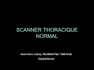 SCANNER THORACIQUE NORMAL .pdf