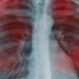 EARLY SIGNS THAT CANCER IS GROWING IN YOUR BODY