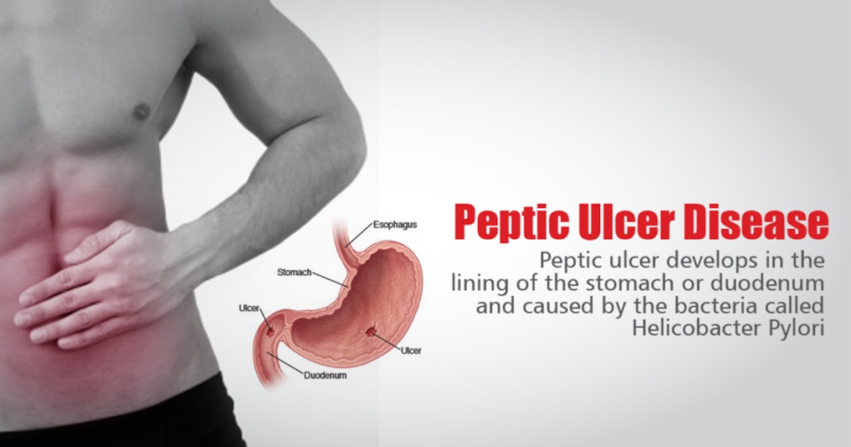 Forever products for Peptic Ulcer (Stomach Ulcer) HOW TO BE HEALTHY