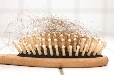 Reverse Hair Loss Naturally Reverse Hair Loss Naturally