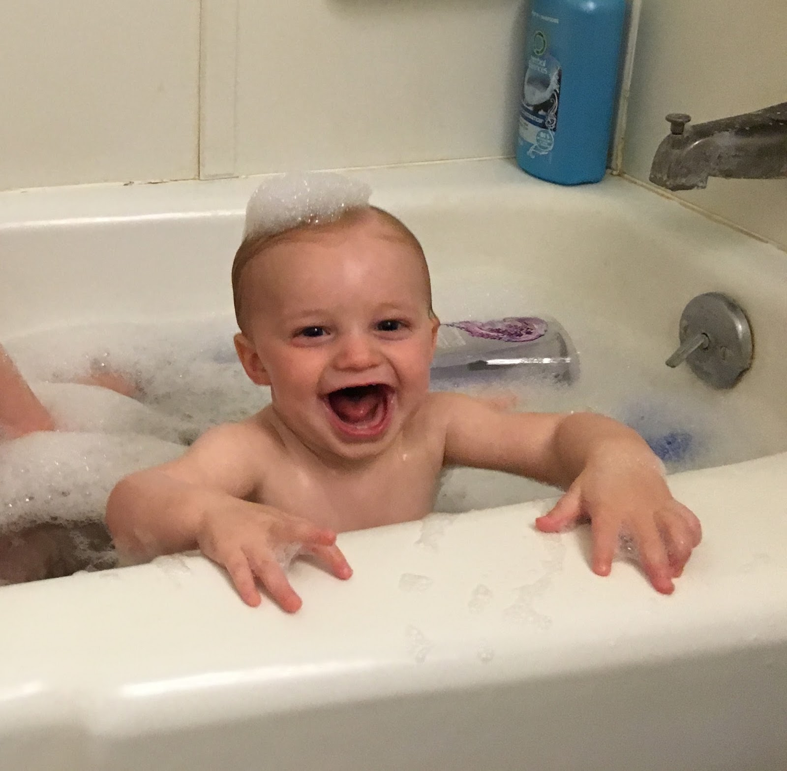 Lindsey's Lemonade Braces