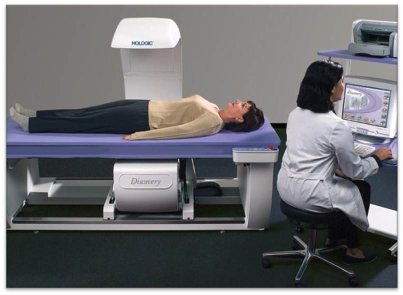 What You Need To Know About Bone Density Screening the benefits of