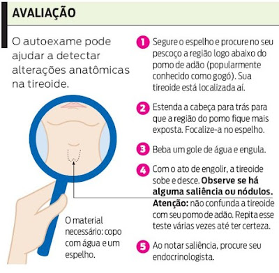 Tiroide