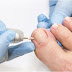 Chiropodist or Podiatrist - What is the Difference?