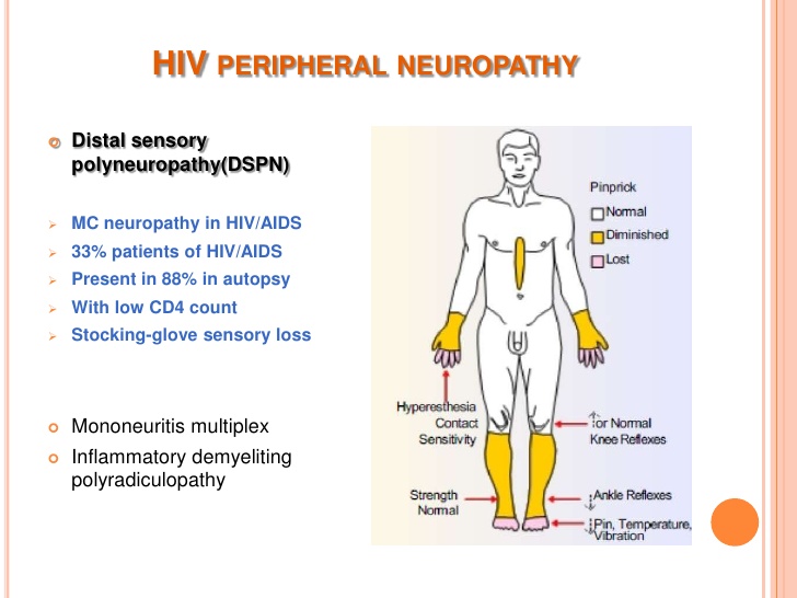 Neuropathy and HIV