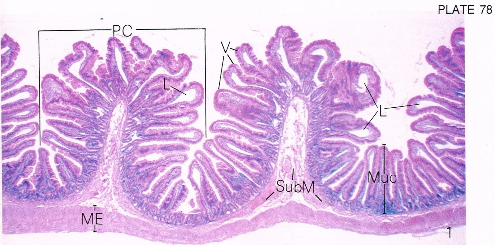 According2Robyn Digestive System, Part 7 The Ileum