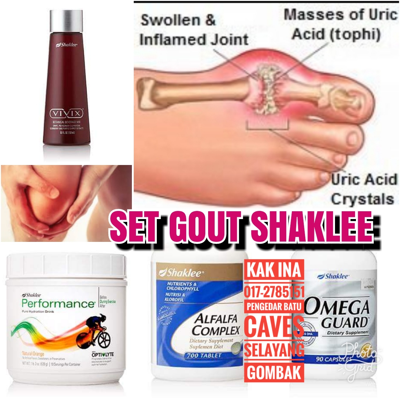 Cergas Sihat Vitamin Semulajadi Selamat GOUT SUPPLEMENT SEMULAJADI