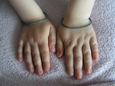 как отучить ребенка грызть ногти