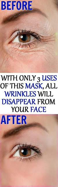 This Magical Mask Will Remove All Kind of Wrinkles Naturally