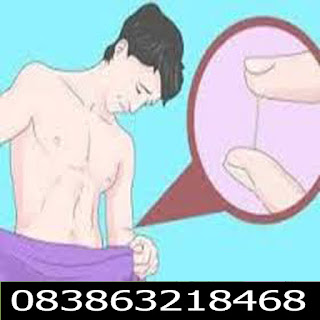 Obat Kutil Kelamin Obat Kutl Kelamin