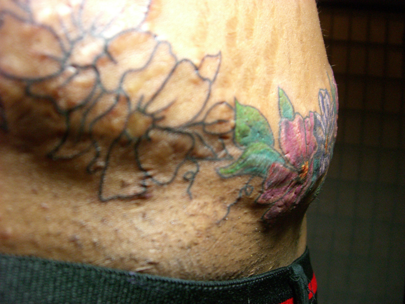 Modern Tattoos: Tattoo Scarring