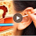 You Will Not Use Cotton Swabs On Your Ears Again After Reading This