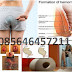 Ada Benjolan Keluar Dari Dalam Anus Pada Saat Mengejan thumbnail
