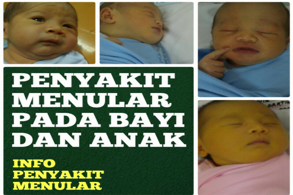 Jika Anak Mengidap 4 Penyakit ini Awas, Sebab Bisa Mudah Menular ke Anak Lain Jika Anak Mengidap 4 Penyakit ini Awas, Sebab Bisa Mudah Menular ke Anak Lain