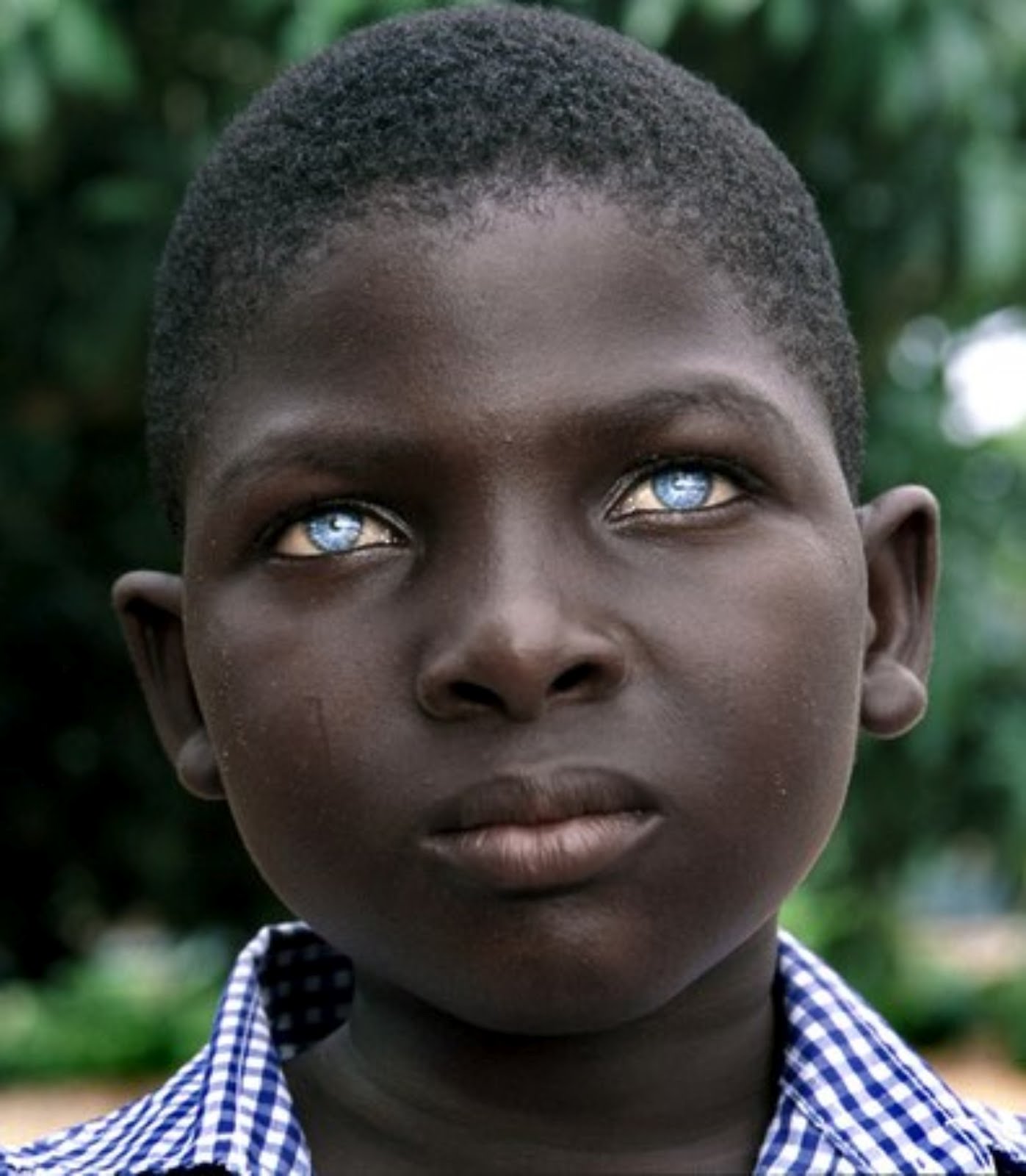 Acting White Acting Black Healthy African Boy With Rare Blue Eyes