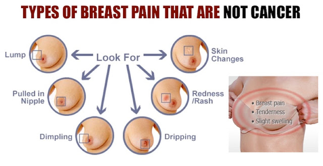 Lumps in Breast that are not breast cancer symptoms Lumps in Breast that are not breast cancer symptoms