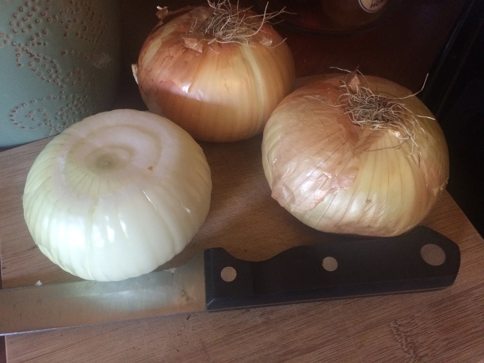 Kevin Songer's Diet for Aorta, Cardiovascular and Gallbladder Health