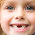 Khi nhổ răng sữa cho trẻ nên lưu ý điều gì? 