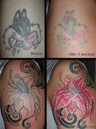 natural tattoo removal effective ways on how to remove tattoos at natural tattoo removal effective ways on how to remove tattoos at