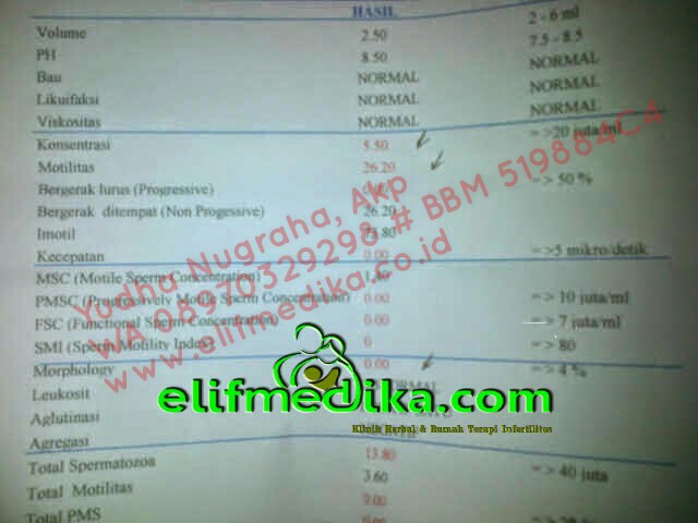 Testimoni Oligozoospermia Testimoni Oligozoospermia