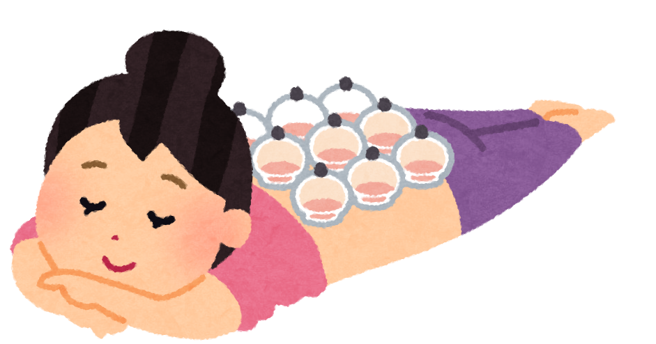 カッピング・吸い玉のイラスト(女性) | かわいいフリー素材集 ...