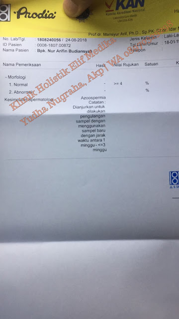 Tahap 1 pengobatan : Hasil masih Azoospermia Tahap 1 pengobatan : Hasil masih Azoospermia