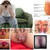 Herbal Ambeien AmbeJOSS Oke Banget thumbnail