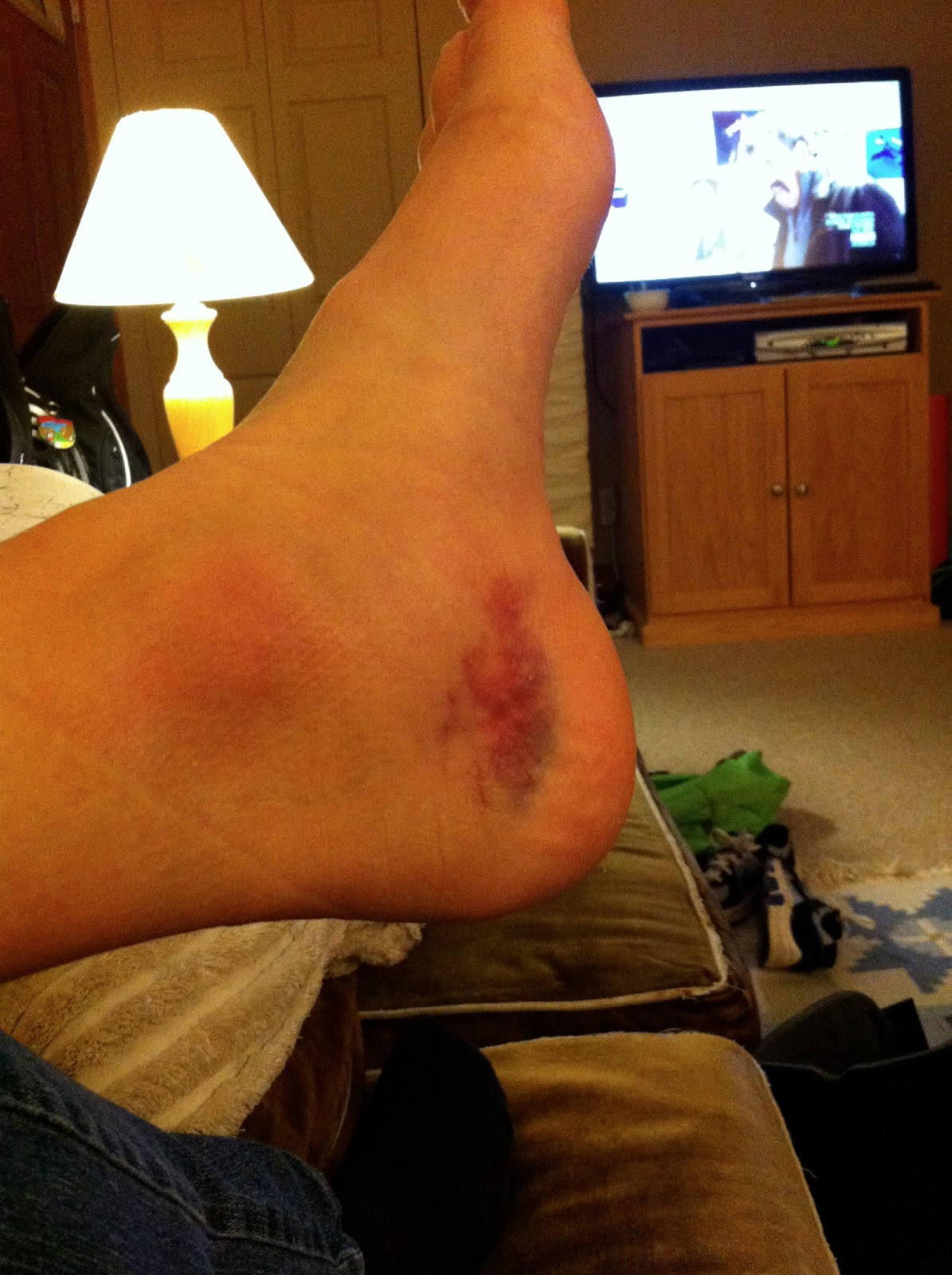 Diary of a Running Mom latest and greatest ankle injury pictures