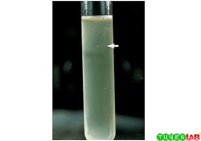 Turbidity produced by enterics when growing in thioglycollate. Notice the gas bubbles at the surface of and in the middle of the medium (arrow). Turbidity produced by enterics when growing in thioglycollate. Notice the gas bubbles at the surface of and in the middle of the medium (arrow).