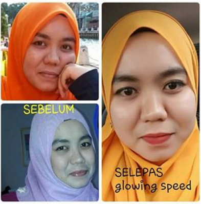 testimoni glowing speed skincare