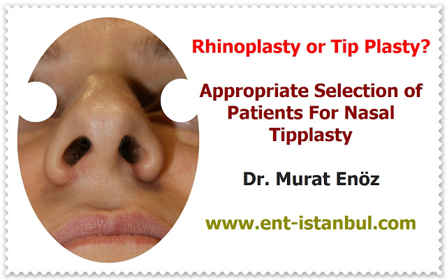 Patient Selection for Tipplasty - Current Concepts in Nasal Tip Plasty - How to Create Natural Nasal Tip? - Creating A Natural-Appearing Nasal Tip Contour - Nose Tip Plasty in Istanbul - Nose Tip Plasty in Turkey