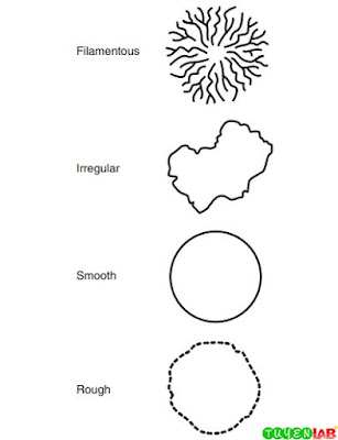 Illustration of form or margin to describe colonial morphology. Illustration of form or margin to describe colonial morphology.