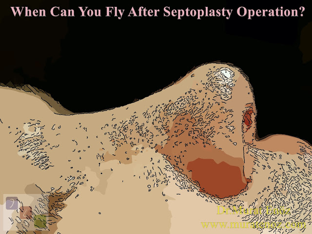 Flying after septoplasty operation - How soon can you fly after a septoplasty operation? - When can you fly after septoplasty operation? - When to start air travelling after septoplasty