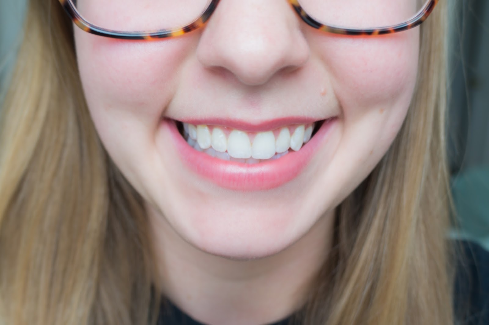 White Teeth White teeth.