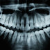 Researchers Discovered That An Alzheimer's Drug Can Help Teeth Repair Cavities