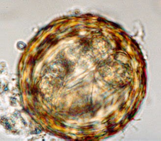 ascaris embrió)