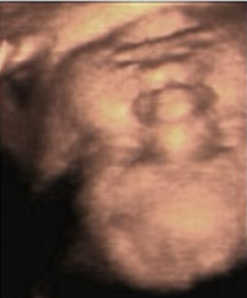 Hafta hafta bebeğin ultrason görüntüleri-39.hafta