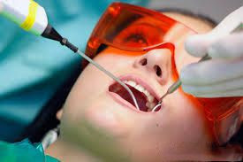 Phương pháp bọc răng sứ titan có hiệu quả